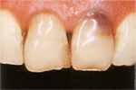 �O����before