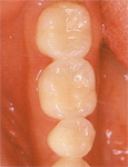 �P����after