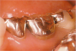 �P����before