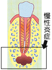 ���됫�������̏ꍇ�̎��̍��̎��ÁF1
